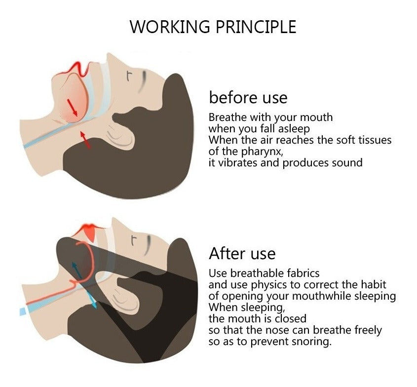 Banda Facial Antironquidos Unisex Compresión Para Barbilla.